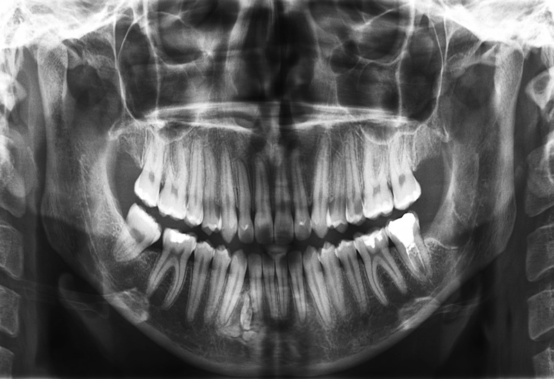 Ortopantomografia Denti - Centro Medico San Marco